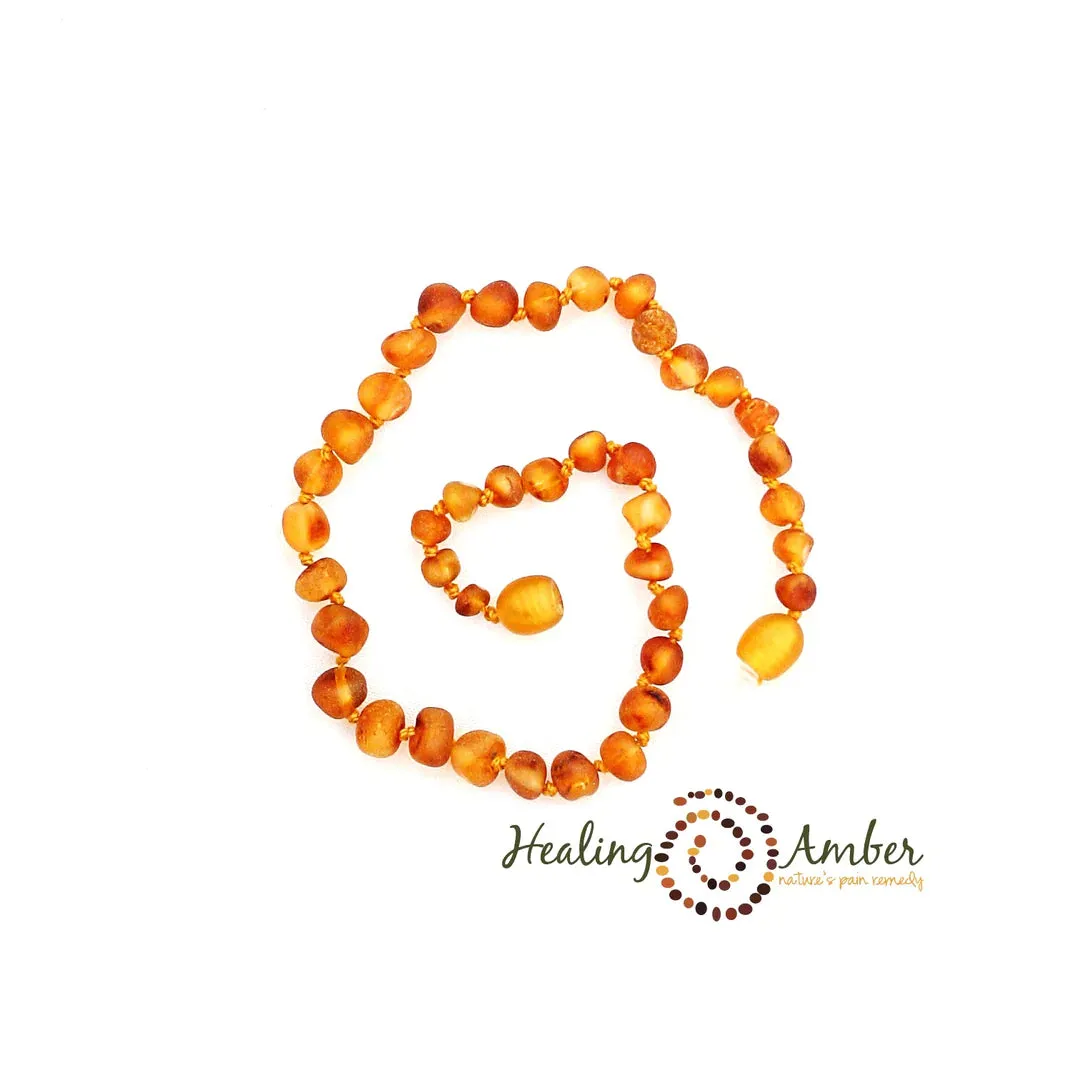 Baltic Amber Necklaces - 25"