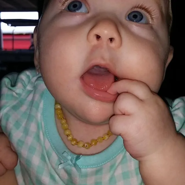 Fast RELIEF for Teething Baby NATURALLY 100% Baltic Amber! Raw Lemon