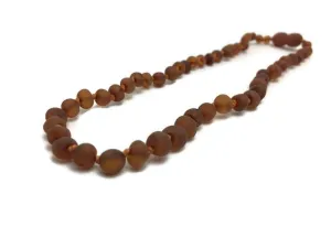 Raw UnPolished Cognac Baltic Amber Necklace for Baby, Infant, Toddler, Big Kid.